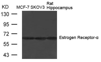 Estrogen Receptor-a(Ab-104)