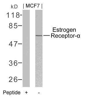 Estrogen Receptor-a(Ab-106)