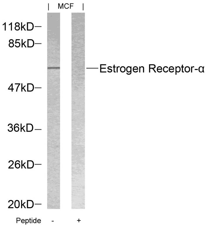 Estrogen Receptor-a(Ab-118)