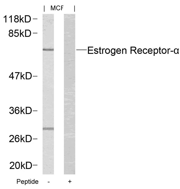 Estrogen Receptor-a(Ab-167)