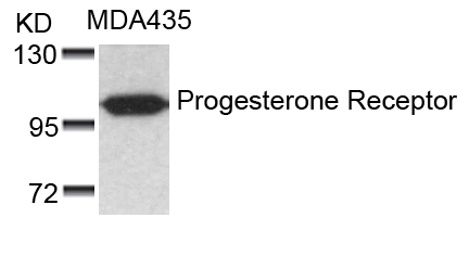 Progesterone Receptor(Ab-190)