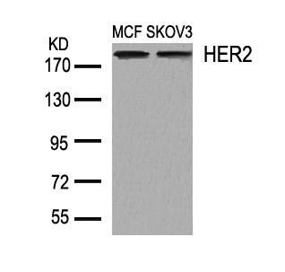 HER2(Ab-1248)