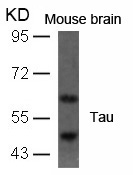 Tau(Ab-396)