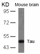 Tau(Ab-404)