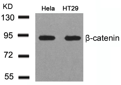 b-Catenin(Ab-41/45)