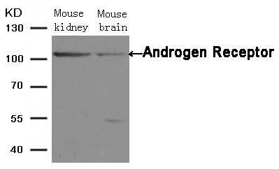 Androgen Receptor(Ab-650)