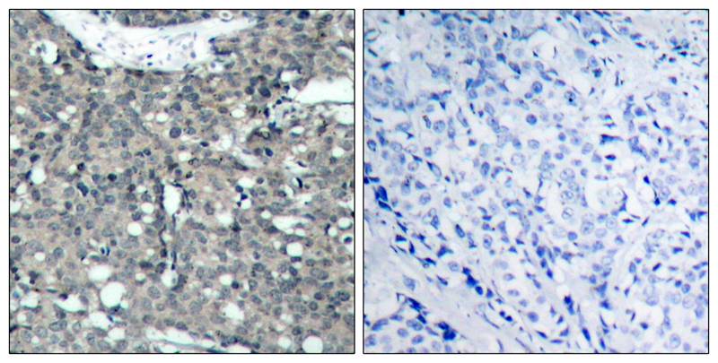 Rabbit Polyclonal Antibody to Paxillin(Ab-118)