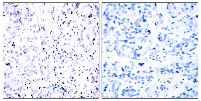 Rabbit Polyclonal Antibody to Rb(Ab-807)