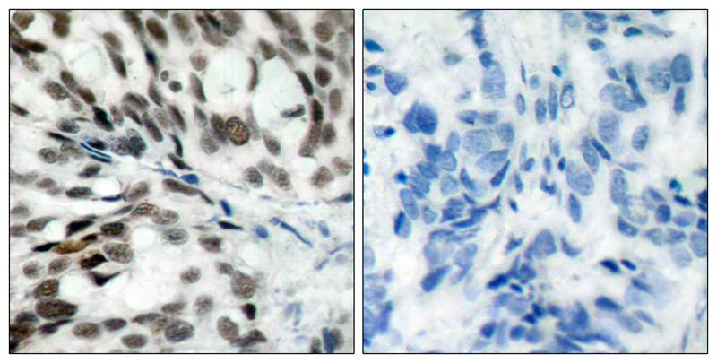 Rabbit Polyclonal Antibody to Rb(Ab-780)