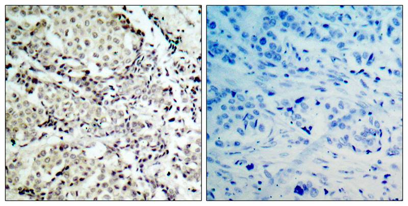 Rabbit Polyclonal Antibody to MKK3(Ab-189)