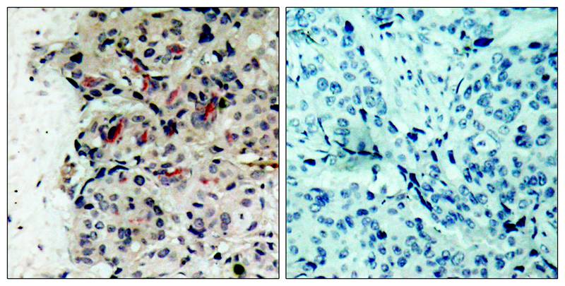 Rabbit Polyclonal Antibody to JAK1(Ab-1022)