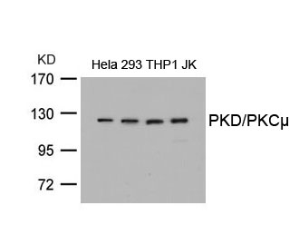 PKD/PKCm(Ab-738)
