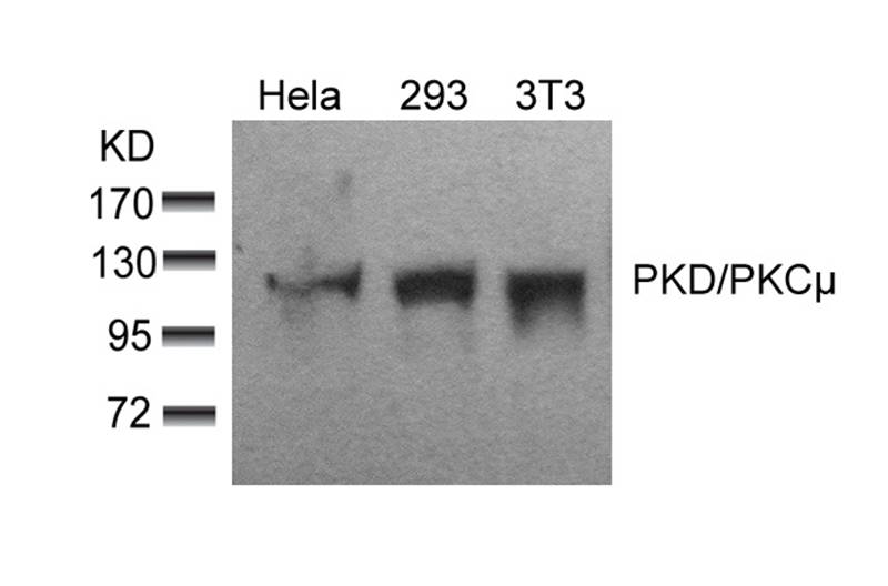 PKD/PKCm(Ab-910)
