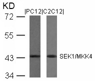 SEK1/MKK4(Ab-80)