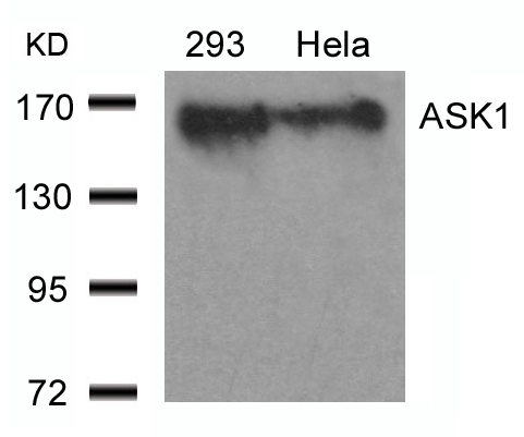ASK1(Ab-966)