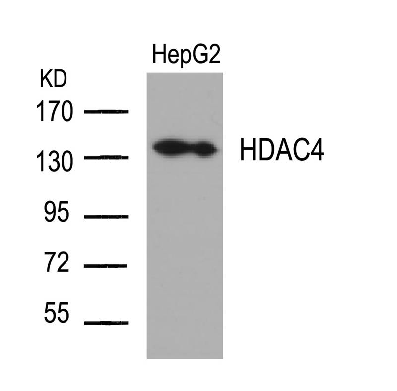 HDAC4(Ab-632)