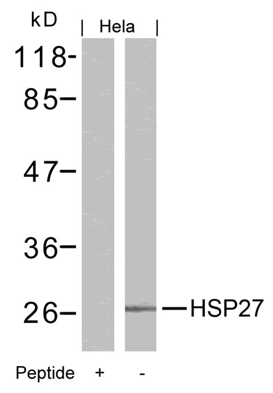 HSP27(Ab-15)