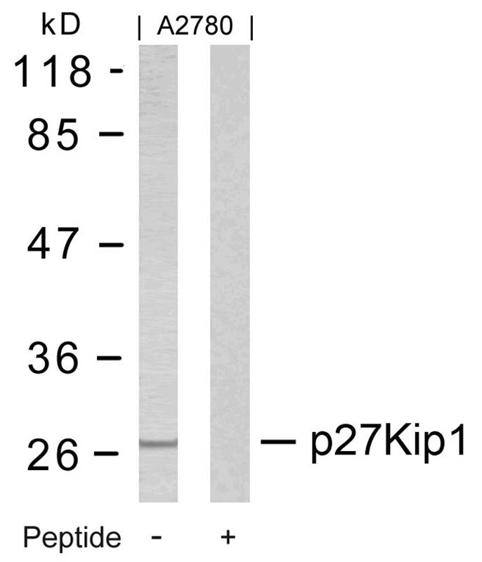 p27Kip1(Ab-10)