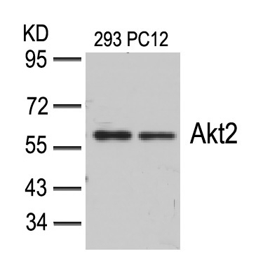 Akt2(Ab-474)