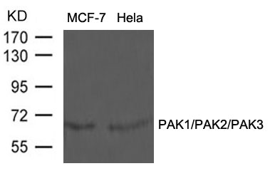 PAK1/PAK2/PAK3(Ab-423/402/421)