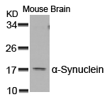 a-Synuclein(Ab-129)