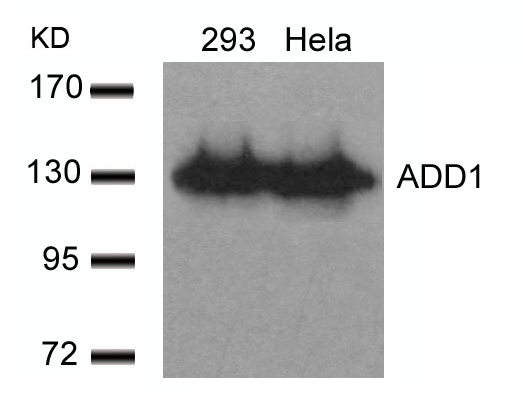 ADD1(Ab-726)