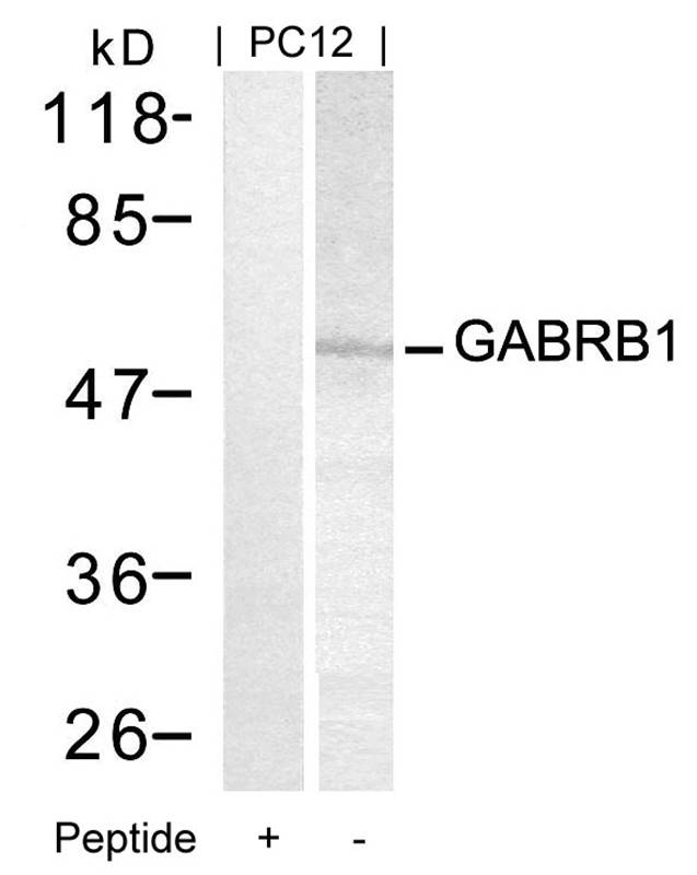 GABRB1(Ab-434)