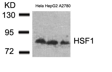 HSF1(Ab-307)