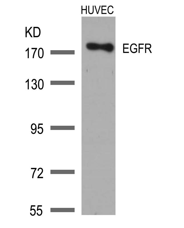 EGFR(Ab-1172)