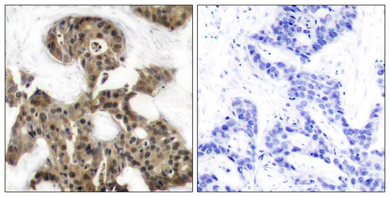 Rabbit Polyclonal Antibody to 4E-BP1(Ab-46)