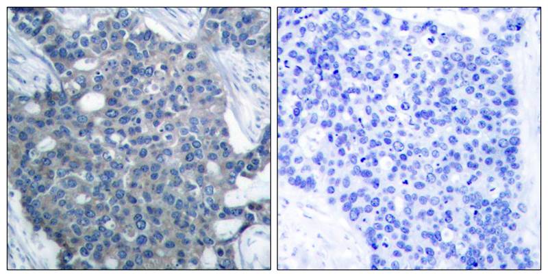 Rabbit Polyclonal Antibody to Stathmin1(Ab-25)
