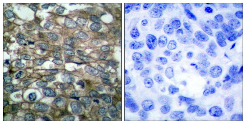 Rabbit Polyclonal Antibody to EGFR(Ab-869)