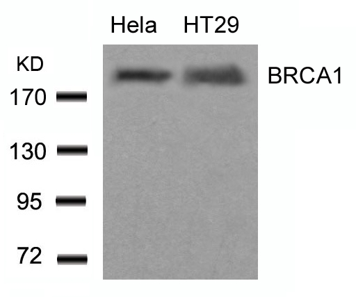 BRCA1(Ab-1423)