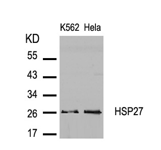 HSP27(Ab-82)