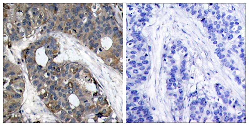 Rabbit Polyclonal Antibody to HSP27(Ab-82)