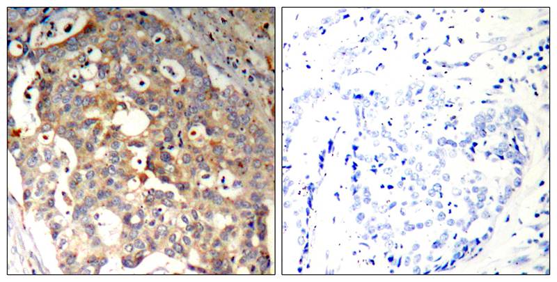Rabbit Polyclonal Antibody to SAPK/JNK(Ab-183)