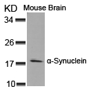 a-Synuclein(Ab-125)