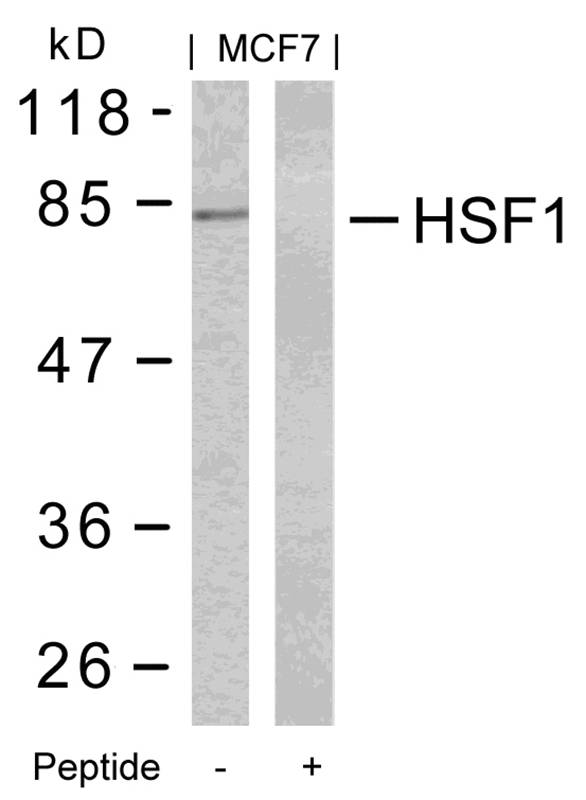 HSF1(Ab-303)