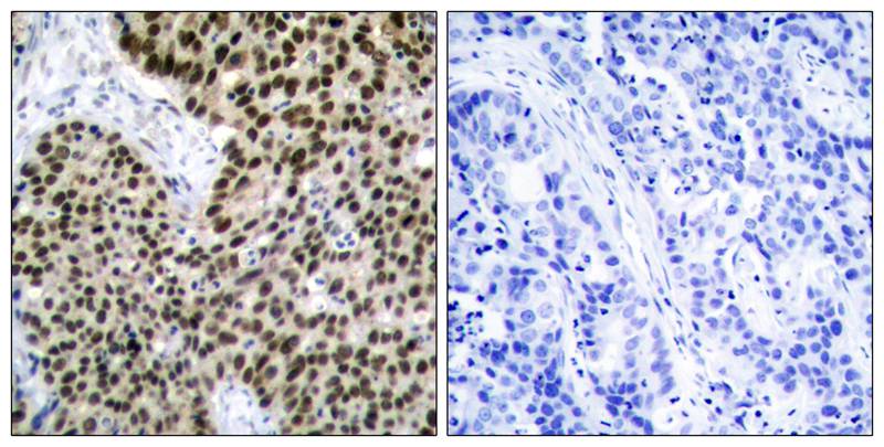 Rabbit Polyclonal Antibody to HSF1(Ab-303)