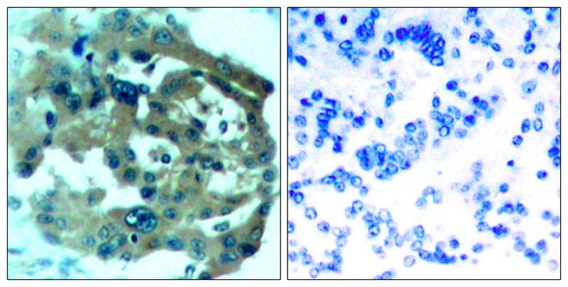 Rabbit Polyclonal Antibody to Merlin(Ab-518)
