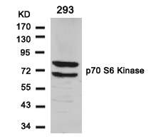 p7S6 Kinase(Ab-411)