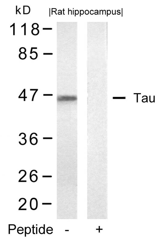 Tau(Ab-422)