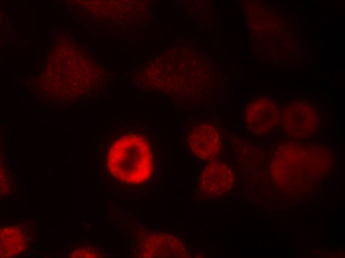 Rabbit Polyclonal Antibody to a-Synuclein(Ab-136)