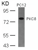 PKCd(Ab-645)