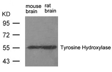 Tyrosine Hydroxylase(Ab-31)