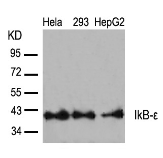 IkB-e(Ab-22)
