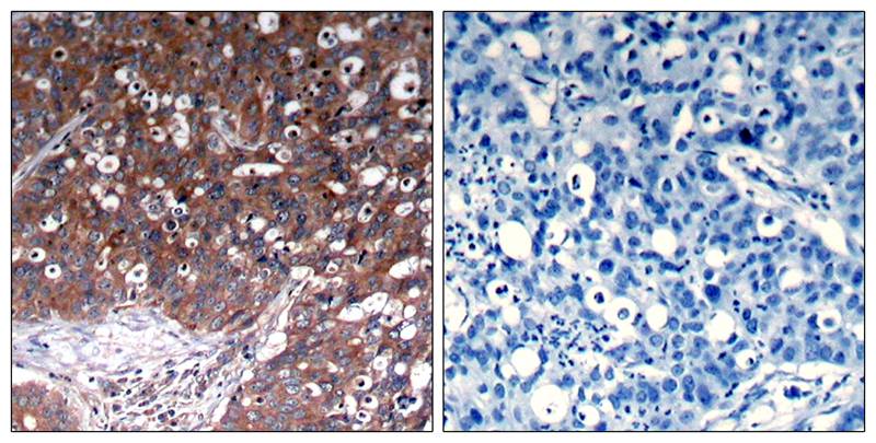 Rabbit Polyclonal Antibody to IGF-1R(Ab-1280)