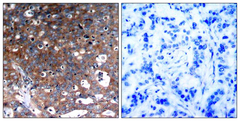 Rabbit Polyclonal Antibody to IGF-1R(Ab-1346)