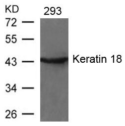 Keratin 18(Ab-33)