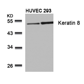 Keratin 8(Ab-74)